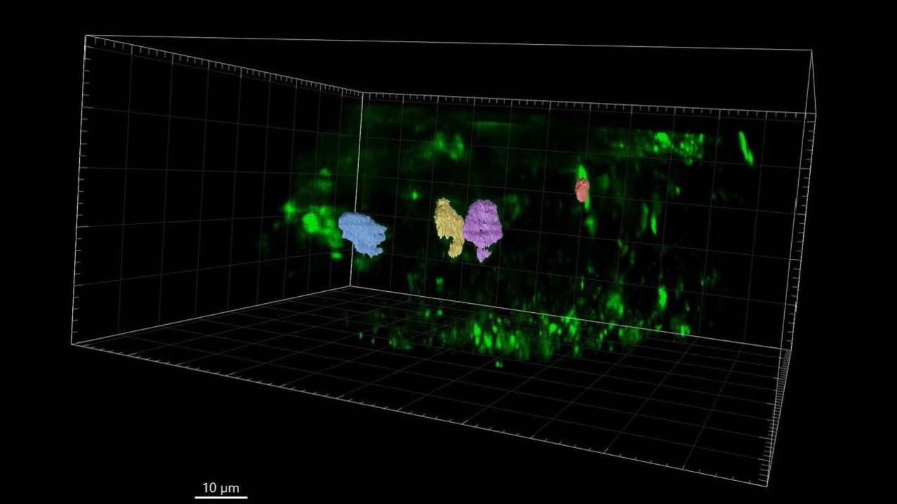 A few colored blobs on a black background. A label at the bottom shows a ruler of 10 microns per inch.
